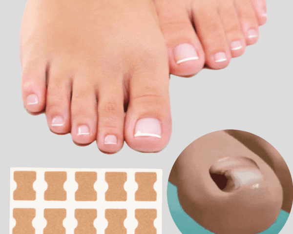 (50% Discount) FinePatches™ | Correction Patches for Beautiful and Healthy Nails