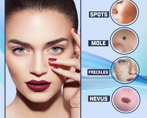 SpotClear™ Dark Spot Vanisher in just Few Weeks
