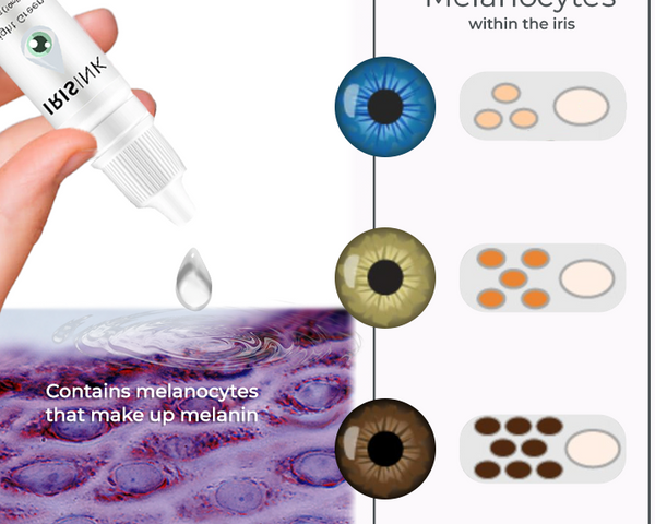 EyeCatcher™ Iris Color Change Eye Drops